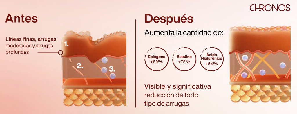 antes y despues de Suero Reductor de Arrugas 